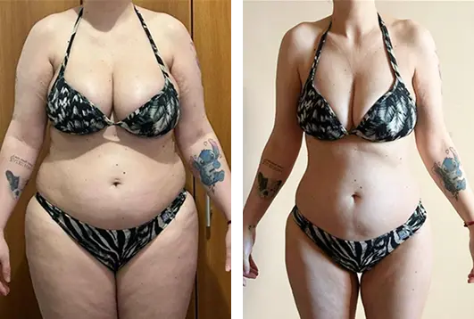 Imagem comparativa de antes e depois de uma mulher vestindo biquíni preto e branco, mostrando redução de peso e contorno corporal mais definido.