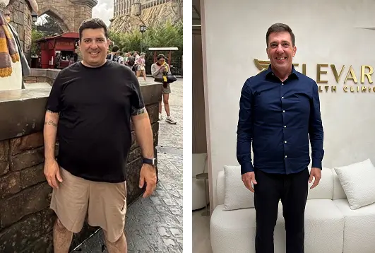 Foto em comparação lado a lado de um homem antes e depois de perder peso, de camiseta preta e bermuda clara na esquerda, e de camisa azul escura e calça preta na direita, sorrindo.